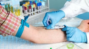 fumar e facer unha análise de sangue dunha vea